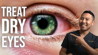 How to Treat Dry Eyes Like an Ophthalmologist