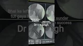 Dr v n singh Bones ke mbbs d ortho hai #paramedicalinstitute #opration #mdadmission #successfull