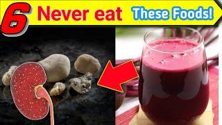 06 Bad foods for kidney stones | These foods can stimulate kidney stones | Never eat these foods