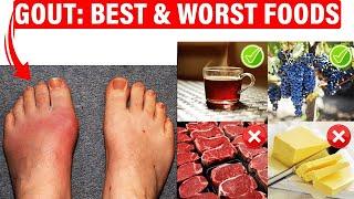 Best Gout Diet & Foods To Avoid [URIC ACID Foods that Cause Gout!]