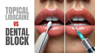 Dental Block or Numbing Cream For Lip Fillers? Here's What's Best | Mabrie Facial Institute