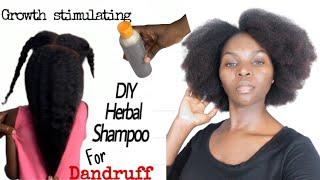 This Homemade Herbal Shampoo will grow your hair and fight scalp infections #herbalshampoo #homemade