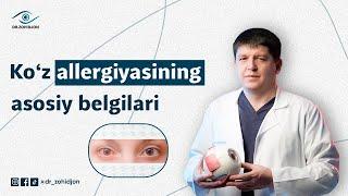 Ko‘z allergiyasining asosiy belgilari | Dr_Zohidjon