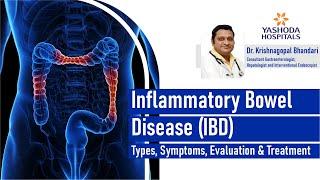 Got Stomach Troubles? It Could Be IBD | Yashoda Hospitals Hyderabad