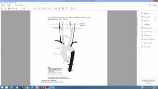 Peripheral Vascular Coding for the Cardiology