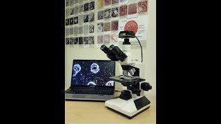 2017 11 14 17 09 The importance of choosing the right microscope for LBA