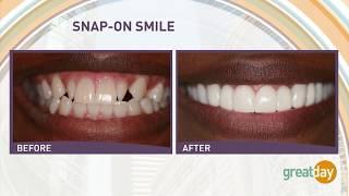 Houston Cosmetic Dentist...SNAP-ON SMILE..Changing lives the affordable way:)