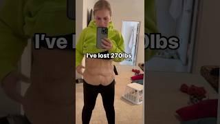 I Lost 270lbs  Would I Still Choose Bariatric Surgery Without Skin Removal? #shorts #looseskin