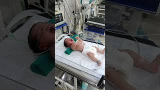 Today new born cute baby boy birth meconium aspiration treatment on CPAP in NICU  ‍️