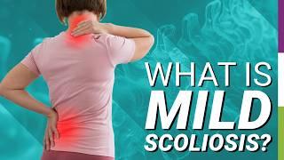 What is Mild Scoliosis?