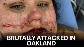 Oakland woman brutally attacked by group of young people | KTVU