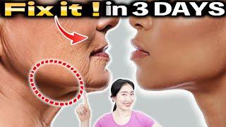 How to Lose Nasolabial Folds and Jowls to Get a Tightened Jawline in 3 Days