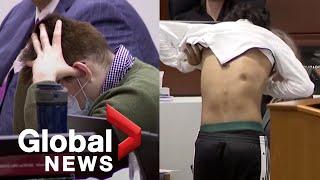 Nikolas Cruz trial: Parkland school shooting survivor shows scars from bullet wounds