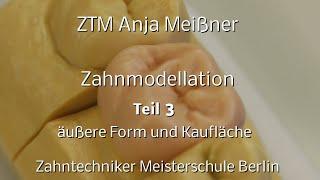 Zahnmodellation – Teil 3 – äußere Form und Kaufläche