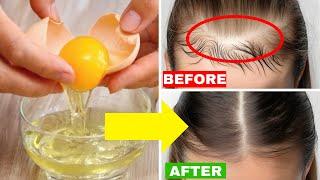 DIY Hair Mask for Natural Hair Growth | Grow Hair Faster with These Ingredients!