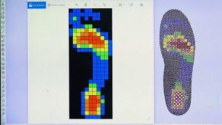 Orthotics Design According to foot Pressure Distribution | 3D Printing | Additive | 3D PRINTech