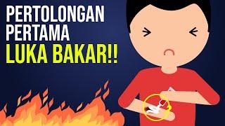 Pertolongan Pertama Luka Bakar!!