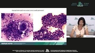 Cytological diagnosis of thyroid cancer: state of the art (Larisa Krasilnikova)