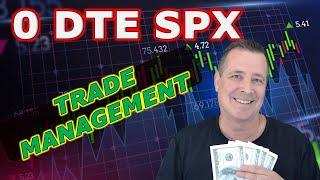 0 DTE SPX Options (Iron Condor Trade Management)