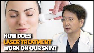 How does Laser Treatment work to tighten our skin?