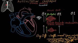 Auscultation cardiaque - Souffles cardiaques/bruits surajoutés/Exercices - Partie 2 Docteur Synapse