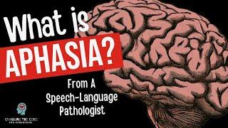 Aphasia after a Stroke