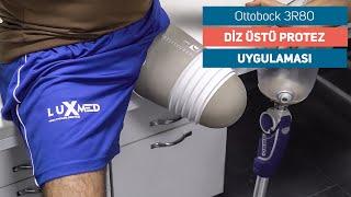 Ottobock 3R80 Prosthesis Use | Luxmed Protez