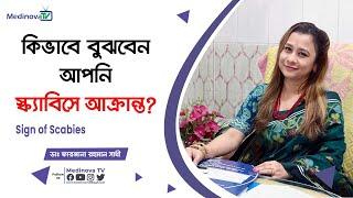 কিভাবে বুঝবেন আপনি স্ক্যাবিসে আক্রান্ত? || Sign of Scabies || Dr Farzana Rahman Shathi