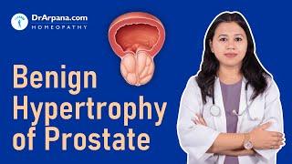 Benign Hypertrophy of Prostrate | Prostrate Enlargement | Homeopathic Medicines by Dr Arpana Samanta