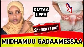 Miidhama garaa / hormaataa maalii dha? Qaama saalaa dubartii (what is Uterine prolapse)