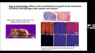 Mechanisms of Inflammation in Lipid-Laden Macrophages after Spinal Cord Injury