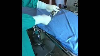 Table speculum holder for stapes surgery - Dr.Suri Prabhu