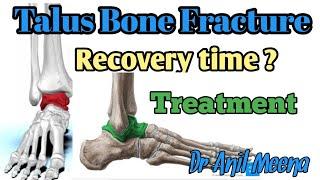 talus bone fracture recovery time | talus bone fracture treatment | talus fracture  | in hindi