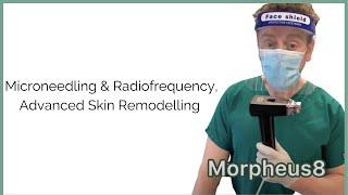 Morpheus8 Microneedling & Radiofrequency, Advanced Skin Remodelling at Quinn Clinics Bristol