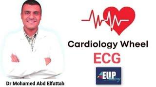 ECG Part 1 Tachycardia Dr Mohamed Abd Elfattah EUP Pediatric Cardiology Wheel