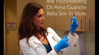 Platelet Rich Plasma and Microneedling