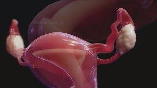 Female Reproductive organ HD 2017