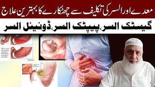 Alsar Ka Ilaj || Stomach Ulcer Disease || Dr Muhammad Arshad Jawed #Healthtips #ulcers