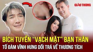 Đàm Vĩnh Hưng bị mất 4 ngón chân, ca sĩ Bích Tuyền tố bạn thân dối trá về thương tật | BGT