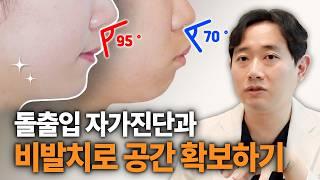 돌출입 자가진단 방법과 비발치 교정시 미세공간을 활용하는 기술 3가지