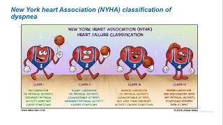 Approach to dyspnea ; English