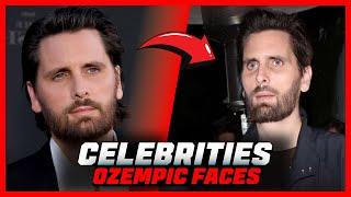 Ozempic Face Has Taken Over Hollywood | Celebrity Secrets REVEALED!