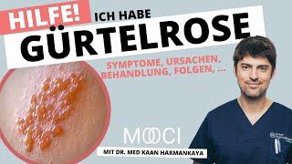 Gürtelrose   Symptome, Behandlung, Ansteckung von Herpes Zoster