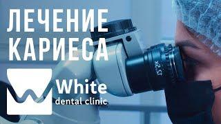 Лечение кариеса в Самаре с помощью микроскопа. Стоматологическая клиника White Dental Clinic Самара