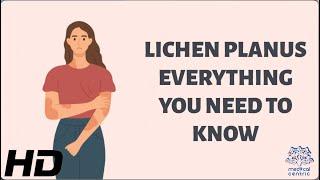 Unlocking the Mystery of Lichen Planus : Everything You Need to Know