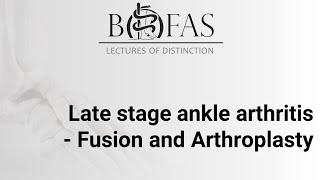 Late Stage Ankle Arthritis - Fusion & Arthroplasty - BOFAS Lectures of Distinction