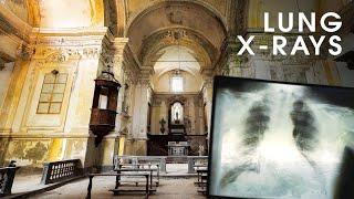 Huge Abandoned Monastery - Filled with Tuberculosis X-Rays!