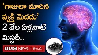 గాజులా మారిన Human Brain మిస్టరీ తెలుసుకున్న శాస్త్రవేత్తలు.. 2000 ఏళ్ల క్రితం Italyలో ఏం జరిగింది?