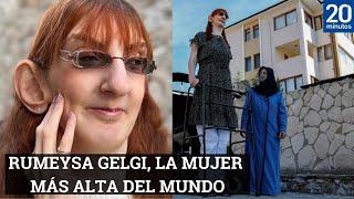 QUIÉN ES RUMEYSA GELGI, LA MUJER MÁS ALTA DEL MUNDO