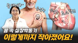 인공심장박동기의 모든 것 | 서울아산병원 차명진 교수